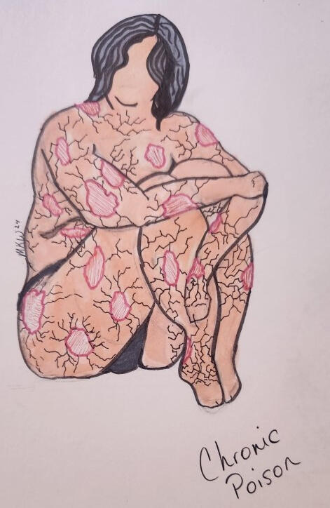 chronic poison